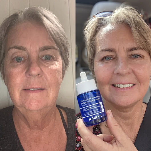 KAELYS — DermaGHK™ · Serum Péptido Azul con Bakuchiol