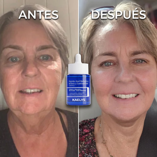 KAELYS — DermaGHK™ · Serum Péptido Azul con Bakuchiol