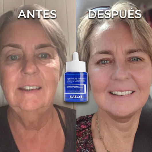 KAELYS — DermaGHK™ · Serum Péptido Azul con Bakuchiol